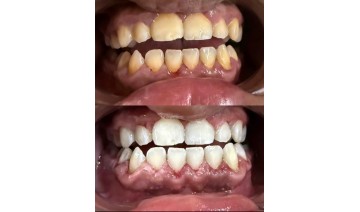 استشارات للأسنان اعتني بأسنانك استشارات للأسنان اعتني بأسنانك